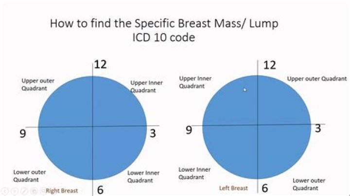 What is the ICD 10 code for left breast nodule?