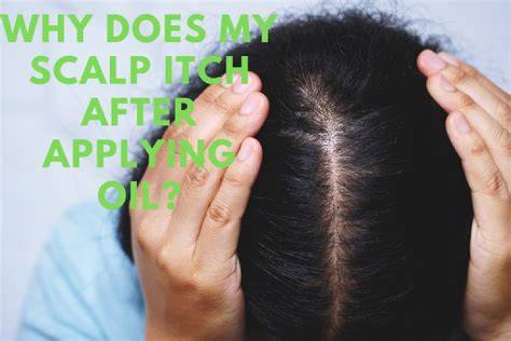 Why does my scalp absorb oil?